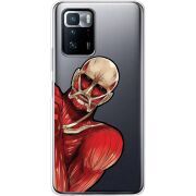 Прозрачный чехол BoxFace Xiaomi Poco X3 GT Титан