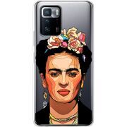 Прозрачный чехол BoxFace Xiaomi Poco X3 GT Фрида Кало
