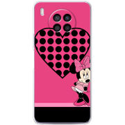 Чехол BoxFace Huawei Nova 8i 