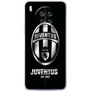 Чехол BoxFace Huawei Nova 8i 