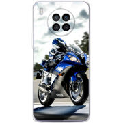 Чехол BoxFace Huawei Nova 8i 