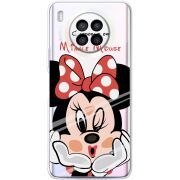 Прозрачный чехол BoxFace Huawei Nova 8i Lady M