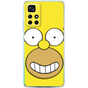 Чехол BoxFace Xiaomi Poco M4 Pro 5G 