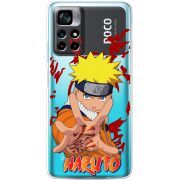 Прозрачный чехол BoxFace Xiaomi Poco M4 Pro 5G Naruto