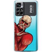 Прозрачный чехол BoxFace Xiaomi Poco M4 Pro 5G Титан