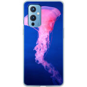 Чехол BoxFace OnePlus 9 