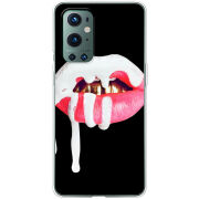 Чехол BoxFace OnePlus 9 Pro 