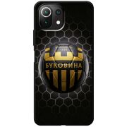 Черный чехол BoxFace Xiaomi Mi 11 Lite 