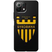 Черный чехол BoxFace Xiaomi Mi 11 Lite 