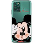 Прозрачный чехол BoxFace ZTE Blade V30 Vita Mister M