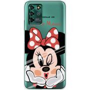 Прозрачный чехол BoxFace ZTE Blade V30 Vita Lady M