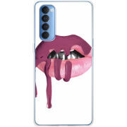 Чехол BoxFace OPPO Reno 4 Pro 