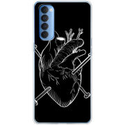 Чехол BoxFace OPPO Reno 4 Pro 