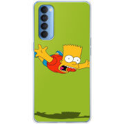 Чехол BoxFace OPPO Reno 4 Pro 