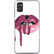 Чехол BoxFace ZTE Blade A7S 2020 