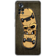 Чехол BoxFace Poco X4 Pro 5G 