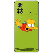 Чехол BoxFace Poco X4 Pro 5G 