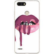 Чехол BoxFace Tecno POP 2F 