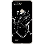 Чехол BoxFace Tecno POP 2F 