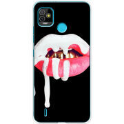 Чехол BoxFace Tecno POP 5 
