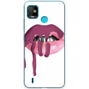 Чехол BoxFace Tecno POP 5 