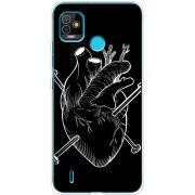 Чехол BoxFace Tecno POP 5 
