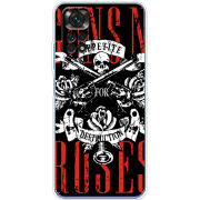 Чехол BoxFace Xiaomi Redmi Note 11 / Note 11S Global Version 