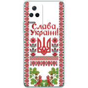 Чехол BoxFace Poco F4 
