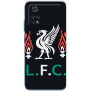Чехол BoxFace Xiaomi Poco M4 Pro 4G L. F. C.