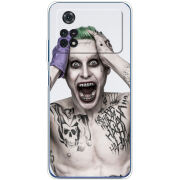Чехол BoxFace Xiaomi Poco M4 Pro 4G 
