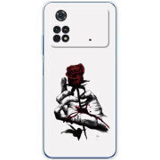 Чехол BoxFace Xiaomi Poco M4 Pro 4G 