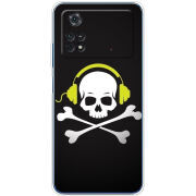 Чехол BoxFace Xiaomi Poco M4 Pro 4G 