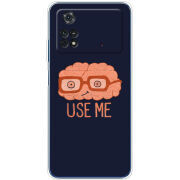 Чехол BoxFace Xiaomi Poco M4 Pro 4G 