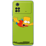 Чехол BoxFace Xiaomi Poco M4 Pro 4G 