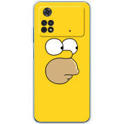 Чехол BoxFace Xiaomi Poco M4 Pro 4G 