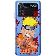 Прозрачный чехол BoxFace Xiaomi Poco M4 Pro 4G Naruto