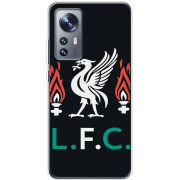 Чехол BoxFace Xiaomi 12 / 12X L. F. C.