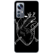 Чехол BoxFace Xiaomi 12 / 12X 