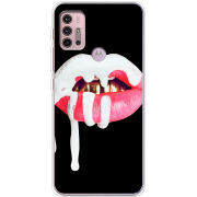 Чехол BoxFace Motorola G10 