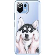 Прозрачный чехол BoxFace Xiaomi Mi 11 Lite Husky