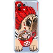 Прозрачный чехол BoxFace Xiaomi 11 Lite 5G NE Winter Puggy