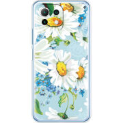 Чехол BoxFace Xiaomi Mi 11 Lite 