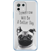 Чехол BoxFace Xiaomi Mi 11 Lite 