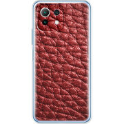 Чехол BoxFace Xiaomi Mi 11 Lite 