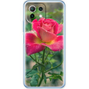 Чехол BoxFace Xiaomi Mi 11 Lite 