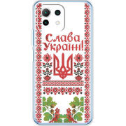 Чехол BoxFace Xiaomi Mi 11 Lite 