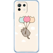 Чехол BoxFace Xiaomi Mi 11 Lite 