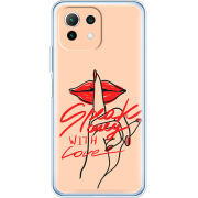 Чехол BoxFace Xiaomi Mi 11 Lite 