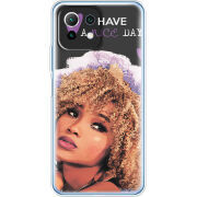 Чехол BoxFace Xiaomi Mi 11 Lite Nice Day