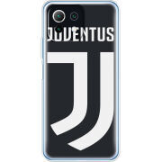 Чехол BoxFace Xiaomi Mi 11 Lite FC J